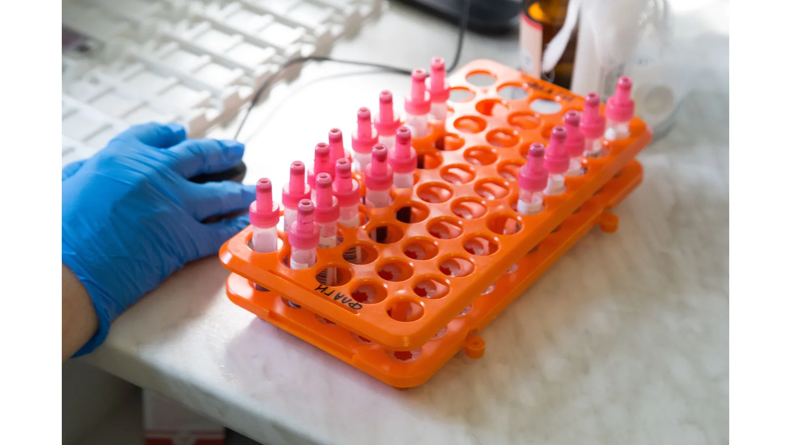 Gloved hand beside sample tubes in an orange laboratory rack